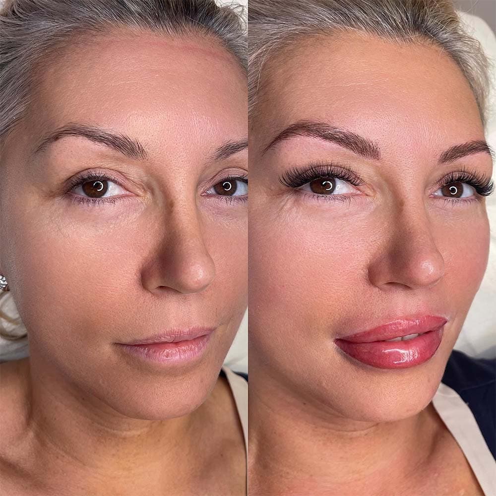 Permanent Makeup Before And After Permanent Makeup Before And After Photos