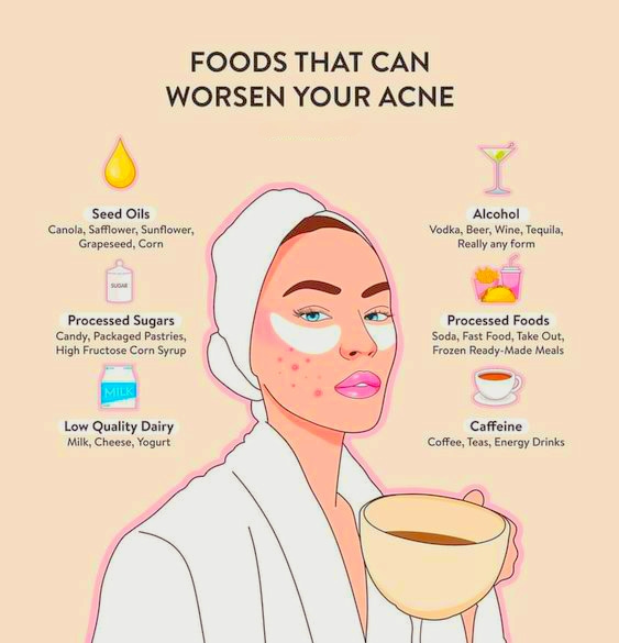Acne Triggering Foods