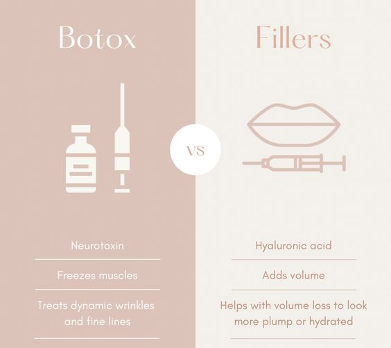 botox vs fillers