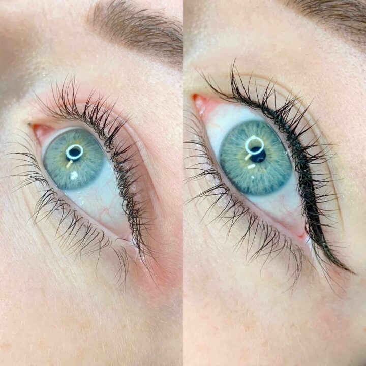 Permanent Eyeliner Before And After Pictures Eyeliner
