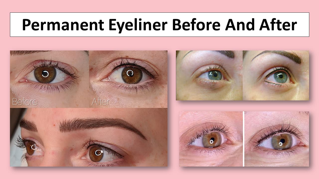 Permanent Eyeliner Before And After Pictures Permanent Eyeliner Before And After Pictures