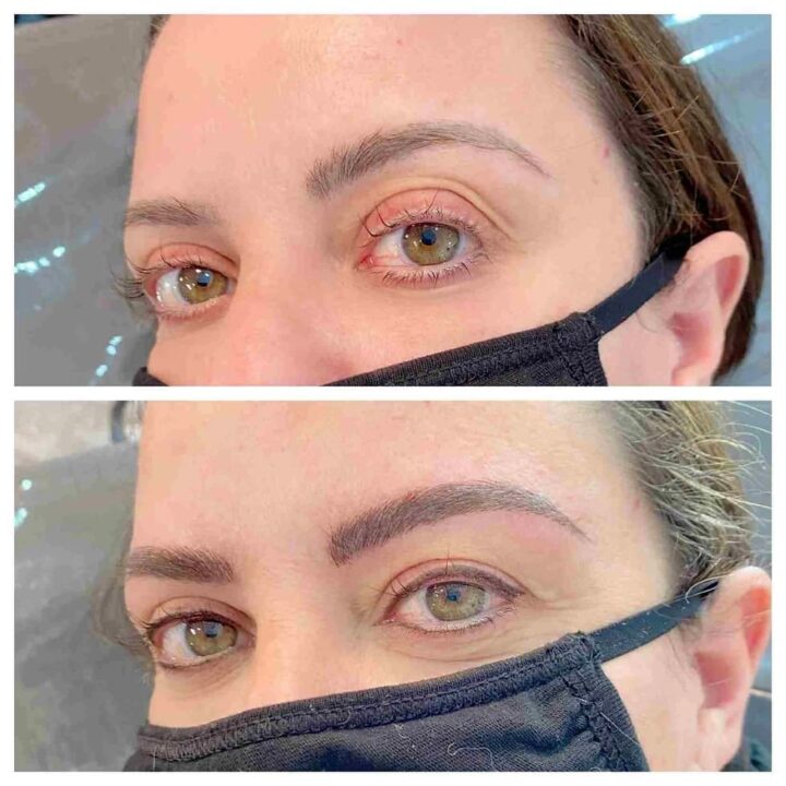 Permanent Eyeliner Before And After Pictures eyeliner permanent makeup before and after
