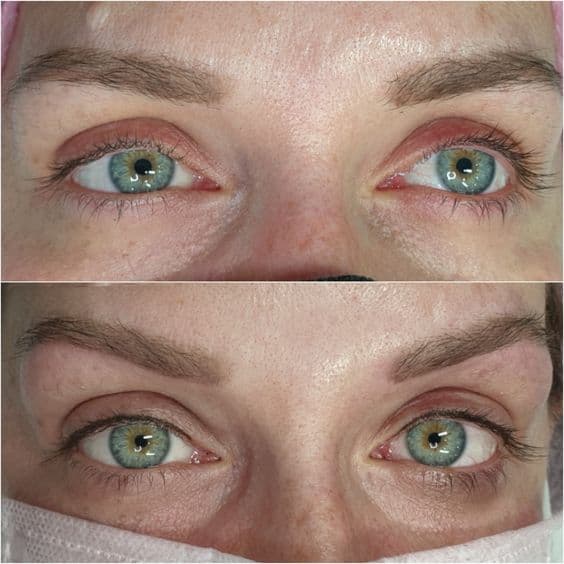 Permanent Eyeliner Before And After Pictures natural-permanent-eyeliner-before-and-after