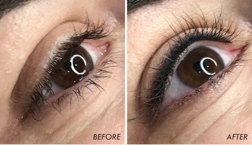 Permanent Eyeliner Before And After Pictures permanent eyeliner before after photos