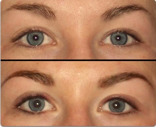 Permanent Eyeliner Before And After Pictures permanent eyeliner before after pics