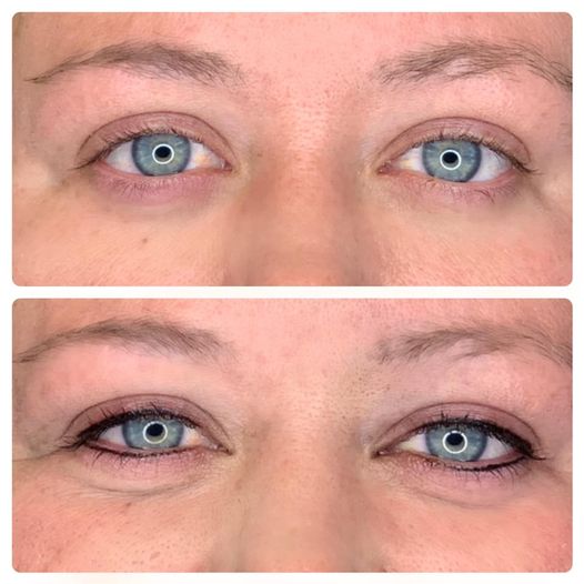 Permanent Eyeliner Before And After Pictures permanent eyeliner before after pictures