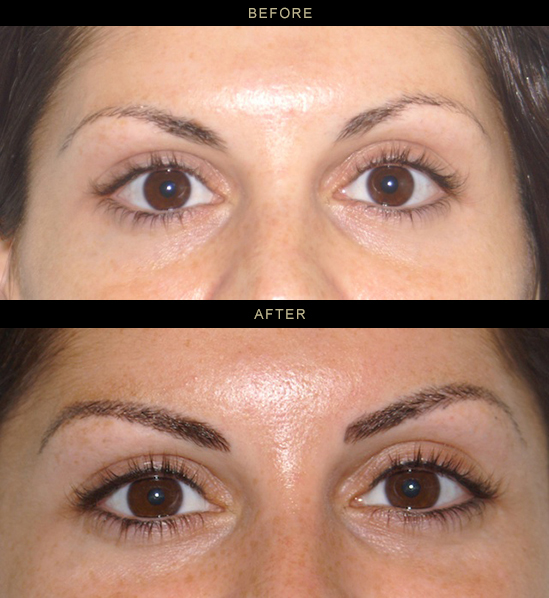 Permanent Eyeliner Before And After Pictures permanent eyeliner before and after images