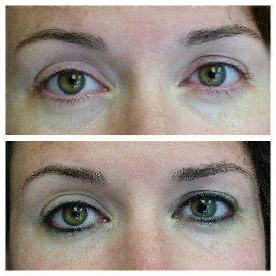 Permanent Eyeliner Before And After Pictures permanent eyeliner pictures before and after
