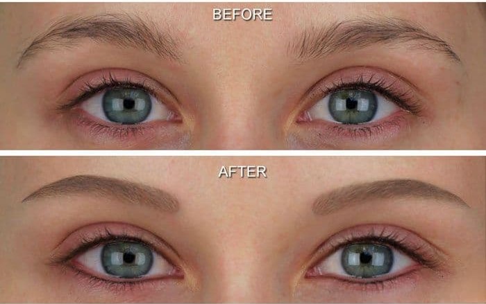 Permanent Eyeliner Before And After Pictures permanent-eyeliner-pictures