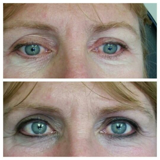 Permanent Eyeliner Before And After Pictures permanent makeup eyeliner before and after