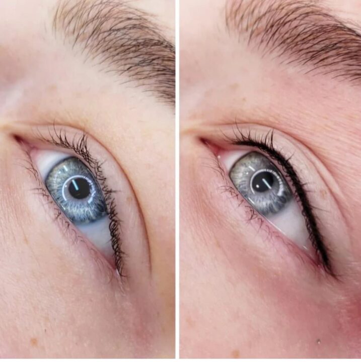 Permanent Eyeliner Before And After Pictures soft-permanent-eyeliner-styles