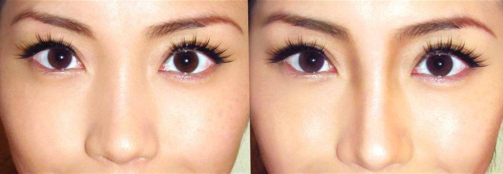 Contouring Before After: How It Completely Changes Your Face before and after contouring pictures