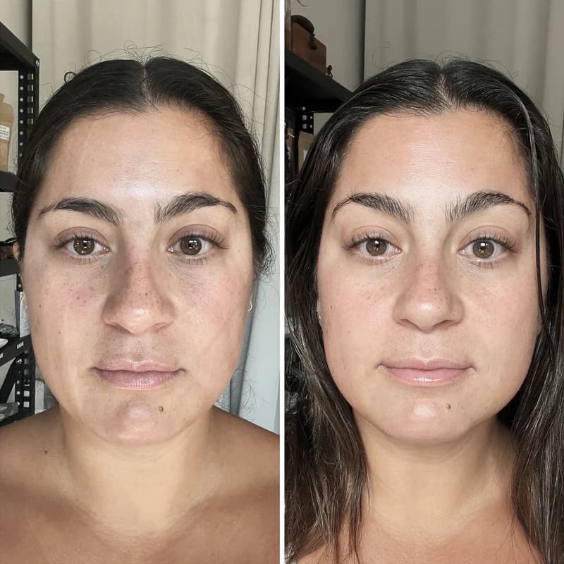 Gua Sha Before And After Photos (Jade, Quartz, and More) Gua sha before and after double chin photos