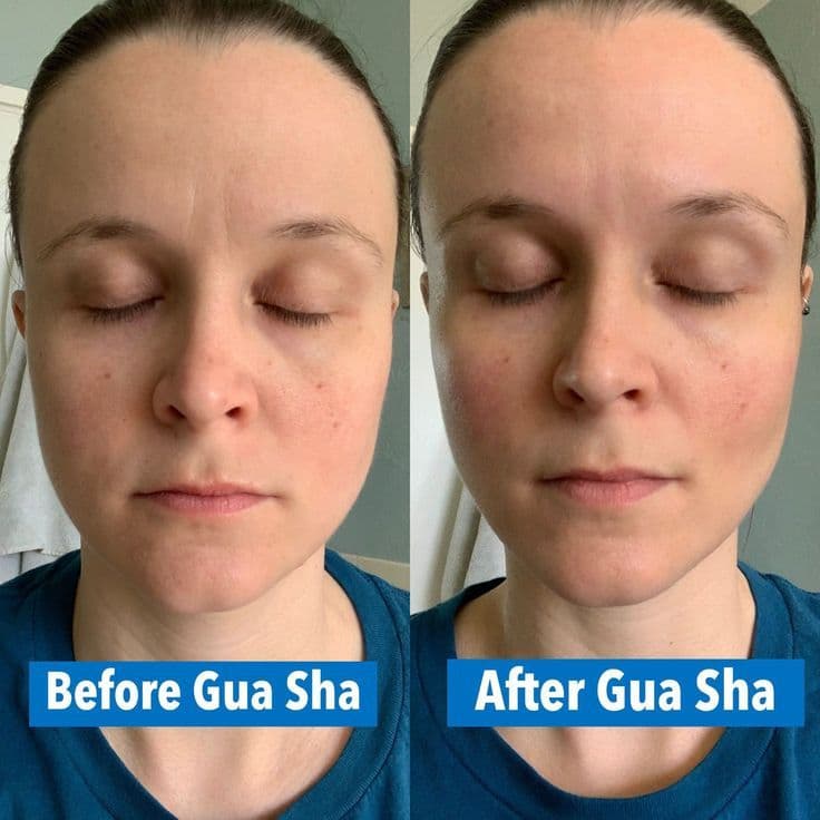 Gua Sha Before And After Photos (Jade, Quartz, and More) Gua sha before and after jawline neck