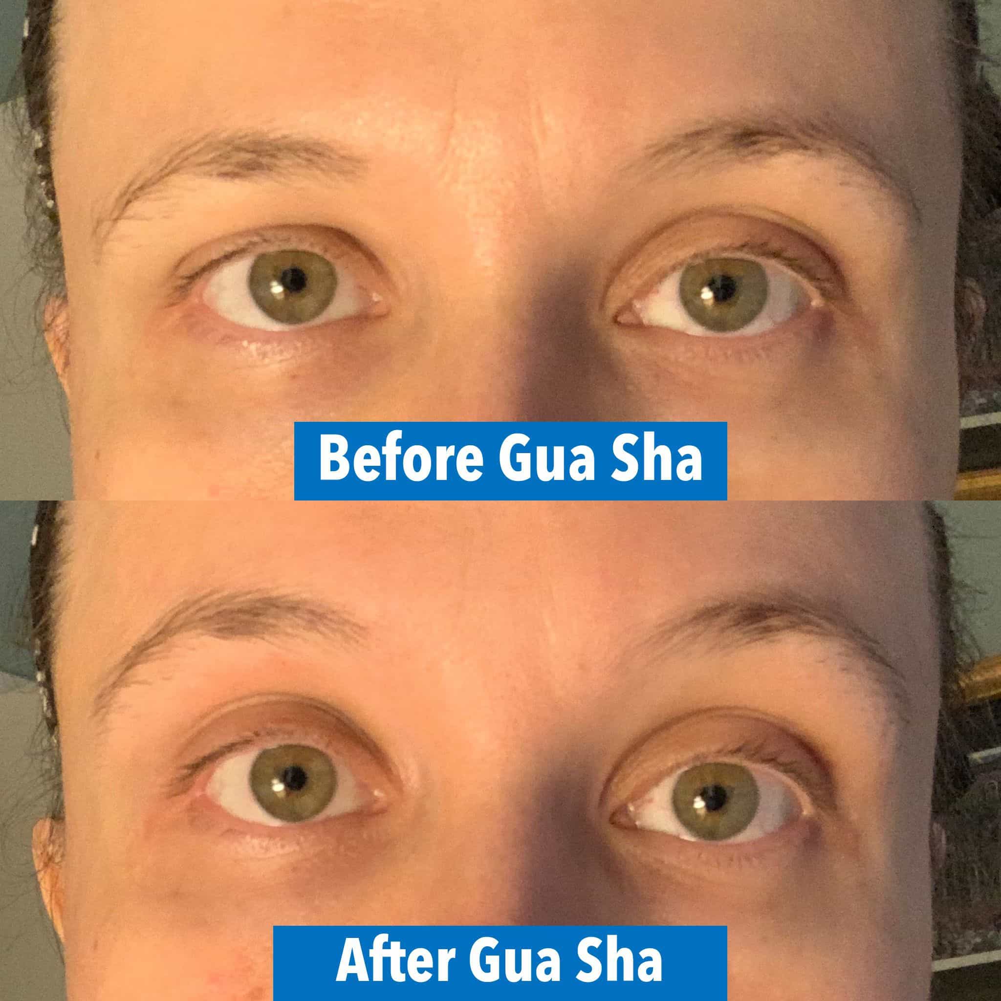 Gua Sha Before And After Photos (Jade, Quartz, and More) Gua sha eyebrow lifiting before and after