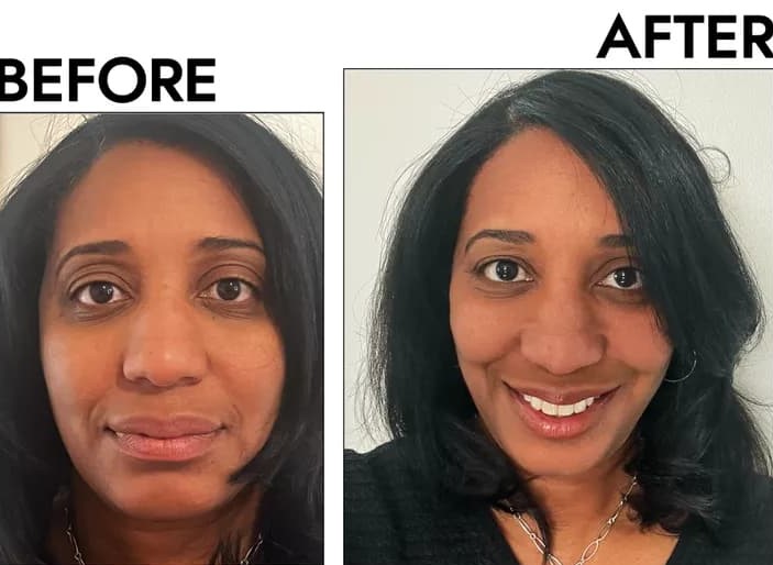 Gua Sha Before And After Photos (Jade, Quartz, and More) Jade gua sha before and after face
