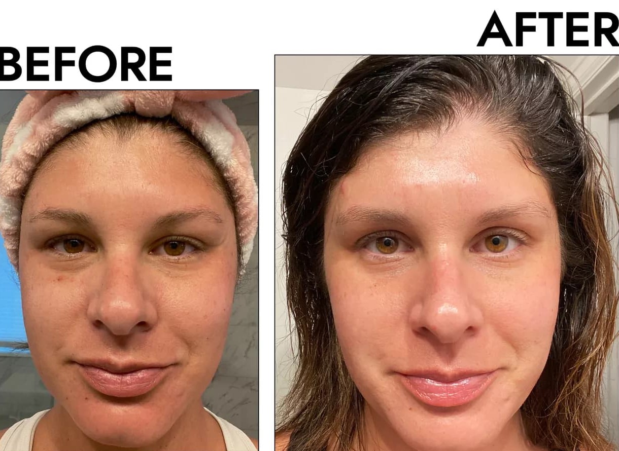 Gua Sha Before And After Photos (Jade, Quartz, and More) Rose quartz gua sha before and after face images
