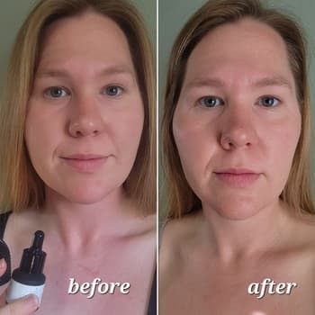Gua Sha Before And After Photos (Jade, Quartz, and More) bian stone before and after