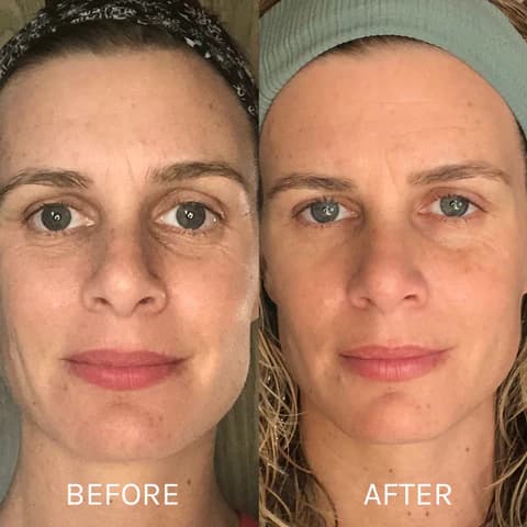 Gua Sha Before And After Photos (Jade, Quartz, and More) gua sha facial before and after