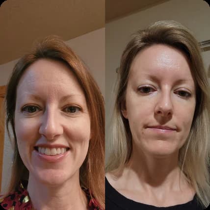 Gua Sha Before And After Photos (Jade, Quartz, and More) rose quartz gua sha before and after photos