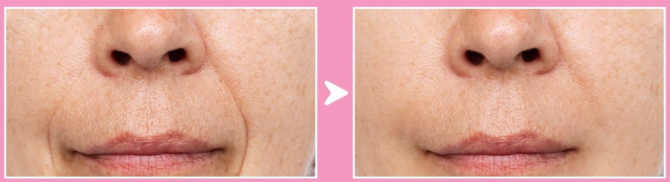Gua Sha Before And After Photos (Jade, Quartz, and More) rose quartz gua sha before and after