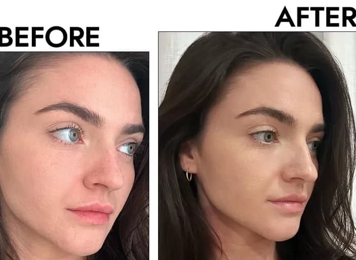 Gua Sha Before And After Photos (Jade, Quartz, and More) stainless steel gua sha before and after