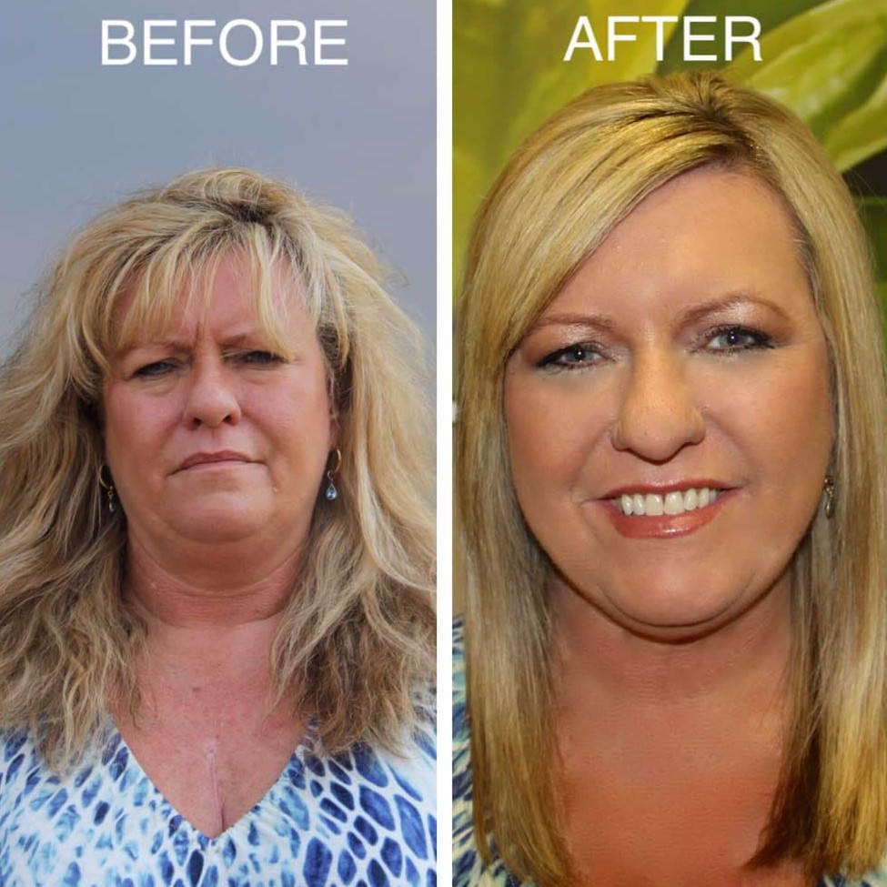 does brazilian blowout straighten curly hair​