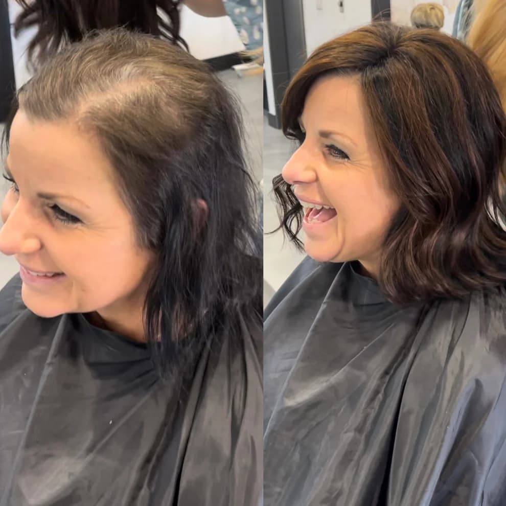Before And After Hair Extensions For Thin Hair On Top Pictures Before And After Hair Extensions For Thin Hair On Top Photos