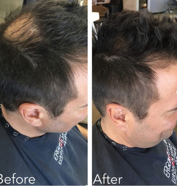 Before And After Hair Extensions For Thin Hair On Top Pictures Before and after hair extensions for thin hair on top men