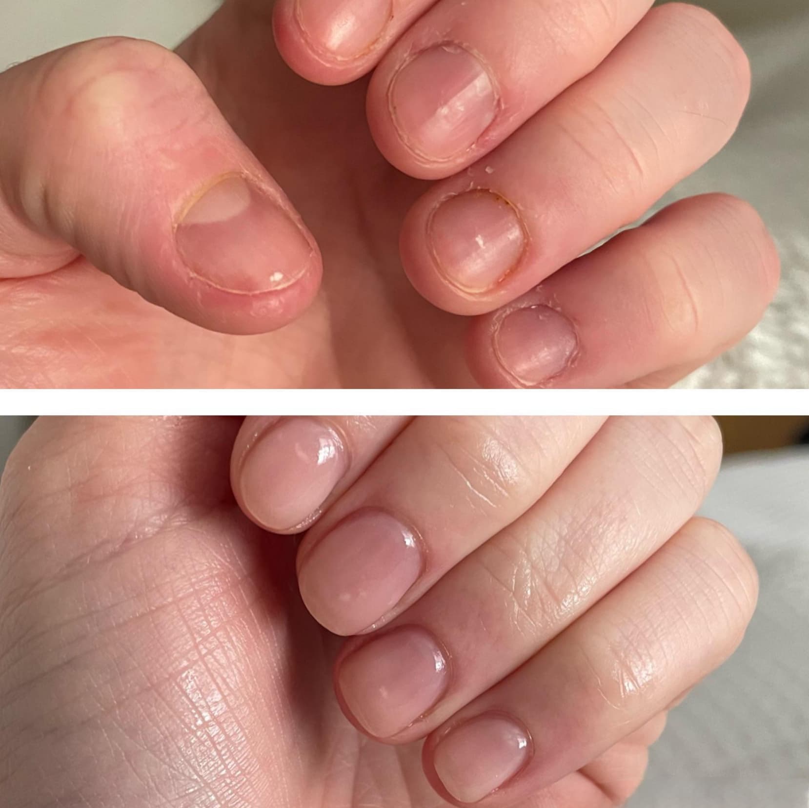Builder Gel Nails Before And After Pictures Builder Gel Nails Before And After