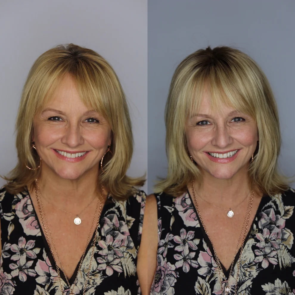 Before And After Hair Extensions For Thin Hair On Top Pictures Hair Extensions Before After Images