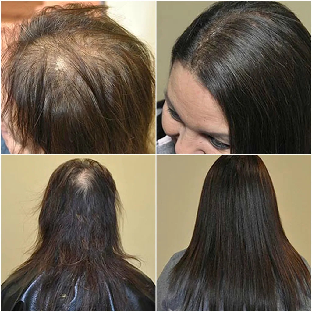 Before And After Hair Extensions For Thin Hair On Top Pictures Hair Extensions Before After pictures