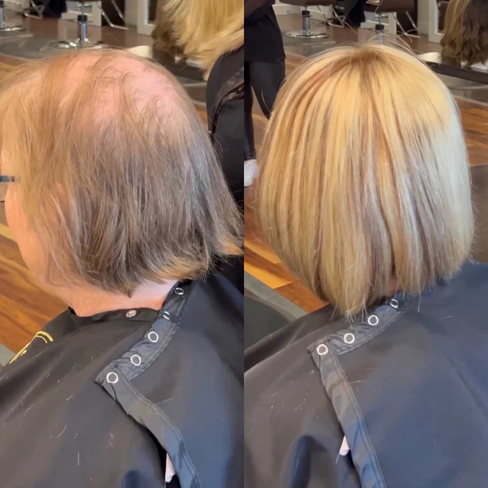 Before And After Hair Extensions For Thin Hair On Top Pictures Hair Extensions For Thin Hair On Top Before After Pics