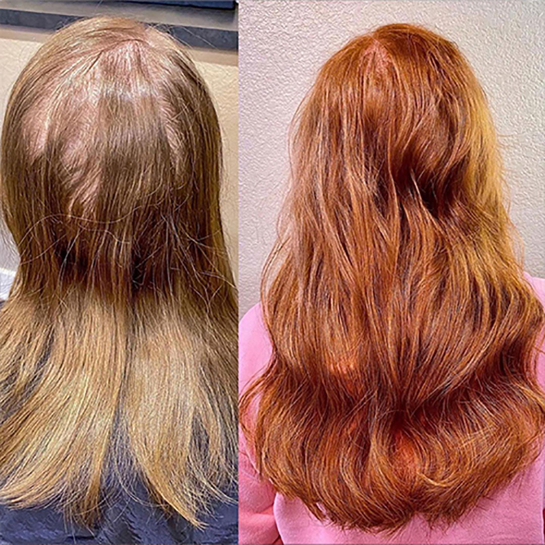 Before And After Hair Extensions For Thin Hair On Top Pictures before and after hair extensions on thin hair