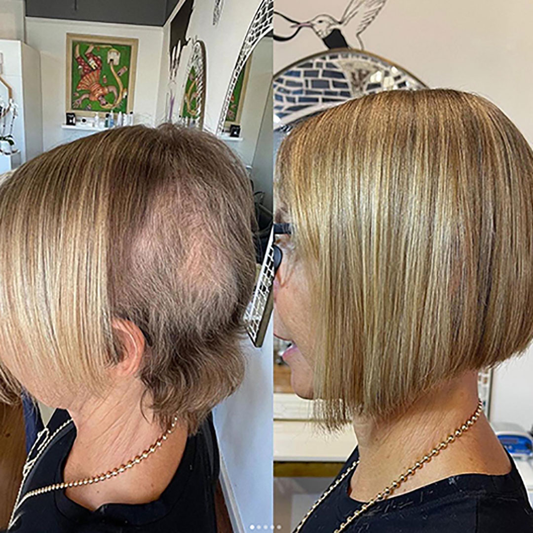 Before And After Hair Extensions For Thin Hair On Top Pictures before and after hair extensions