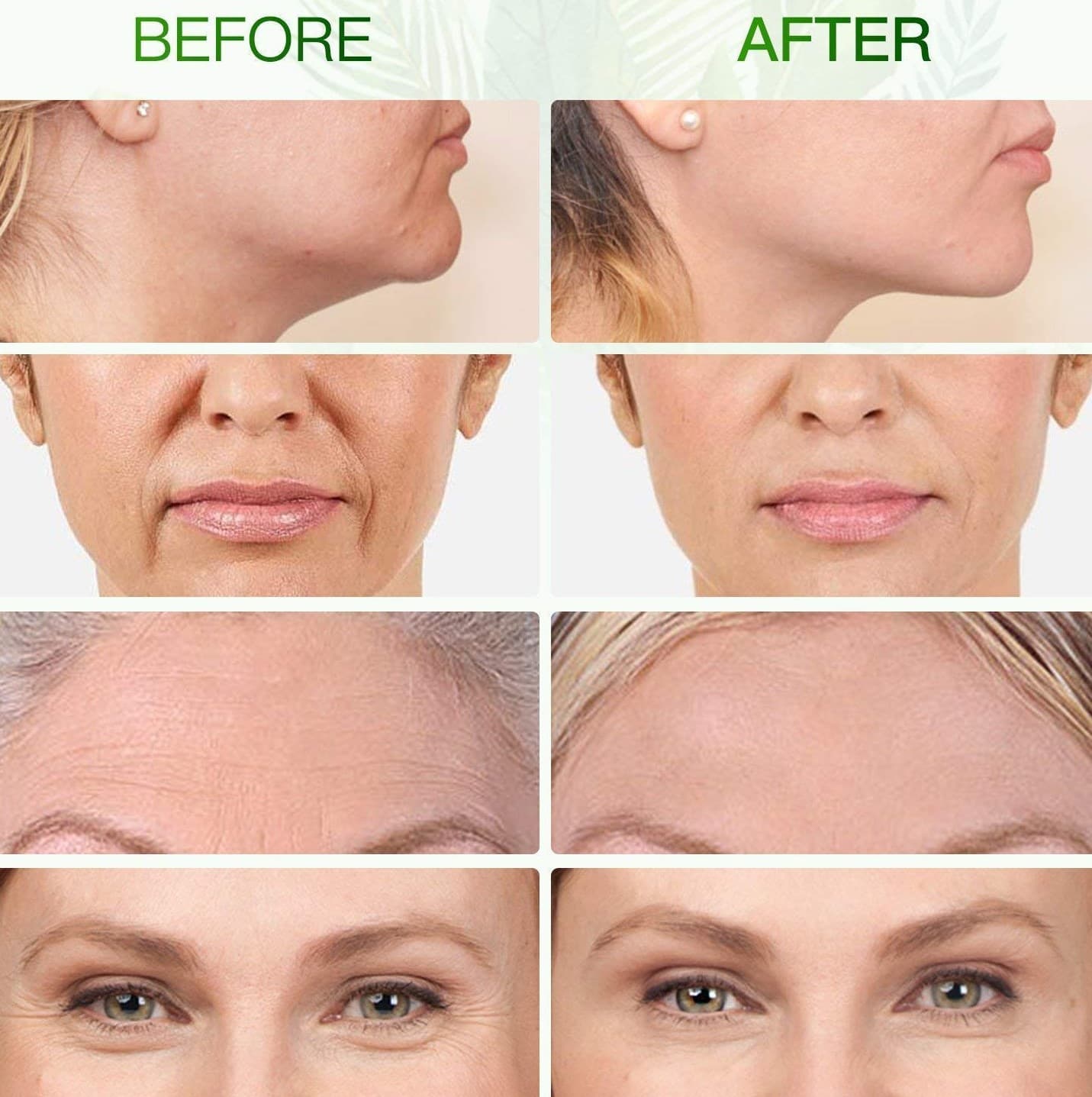 Jade Roller Before And After Pictures before and after jade roller