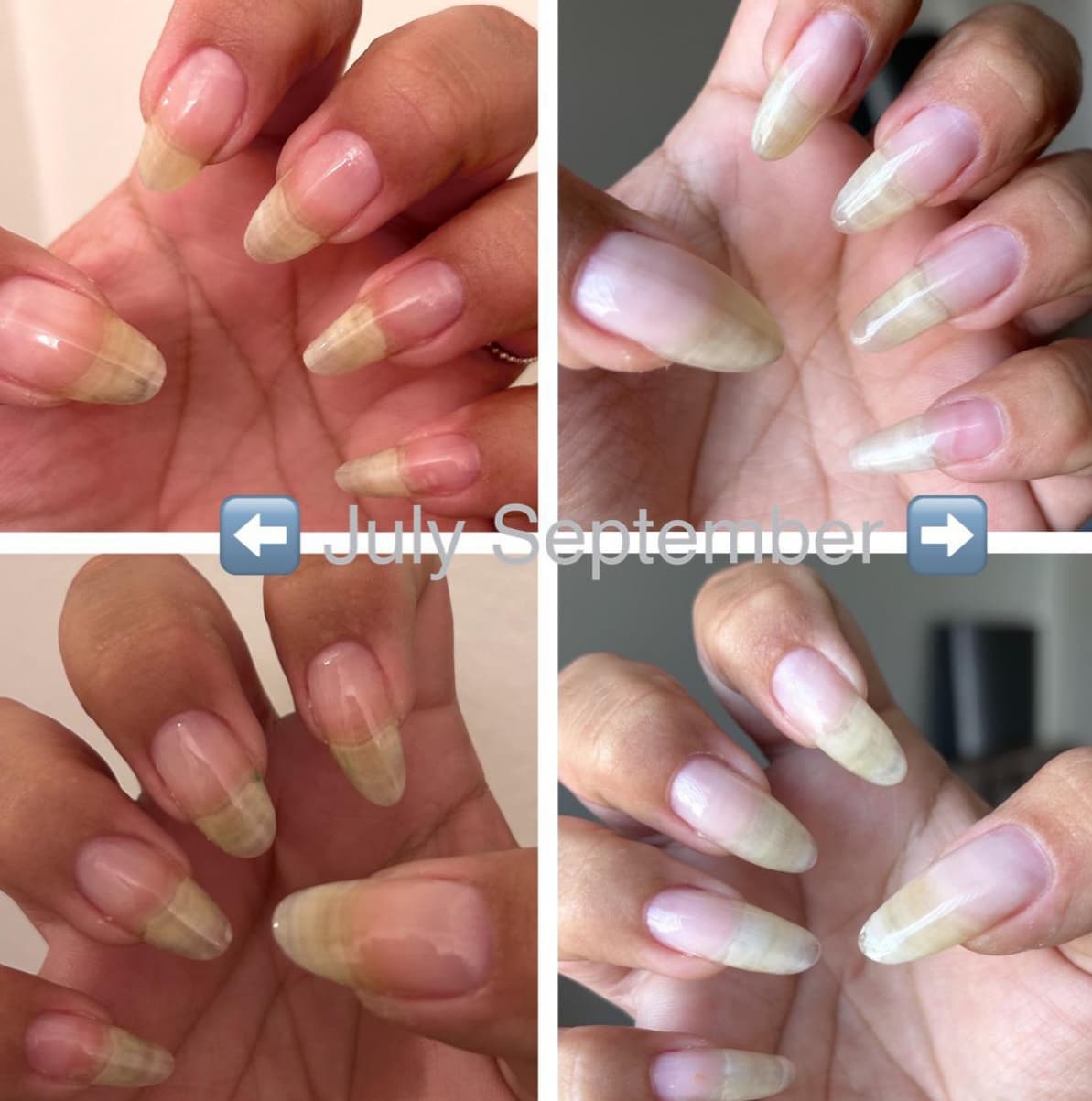Builder Gel Nails Before And After Pictures builder gel nail growth