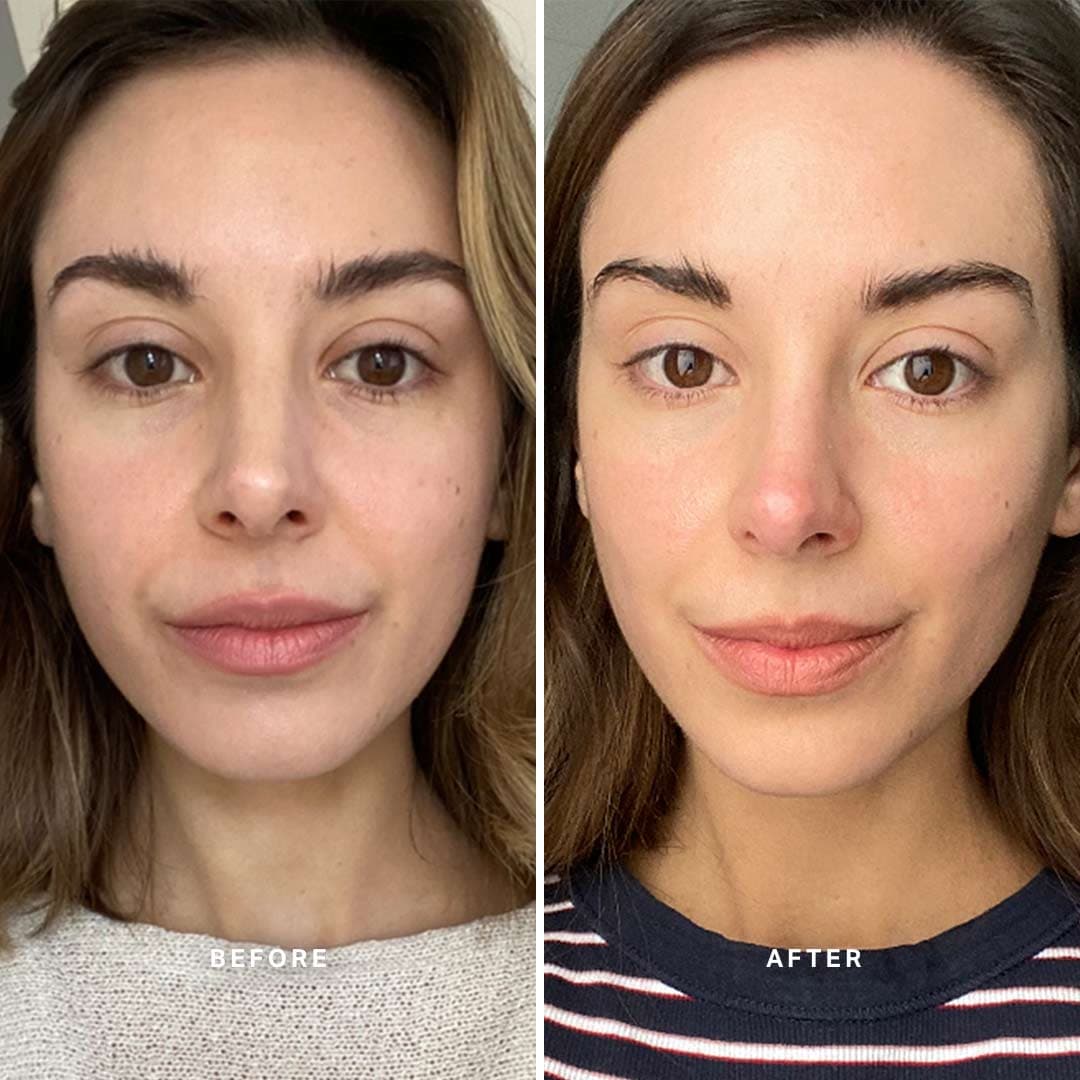 Face Before And After Vitamin C Serum Pictures vitamin c serum face before and after images