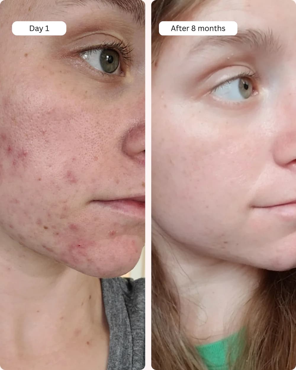 vitamin c serum on face before and after​ pics