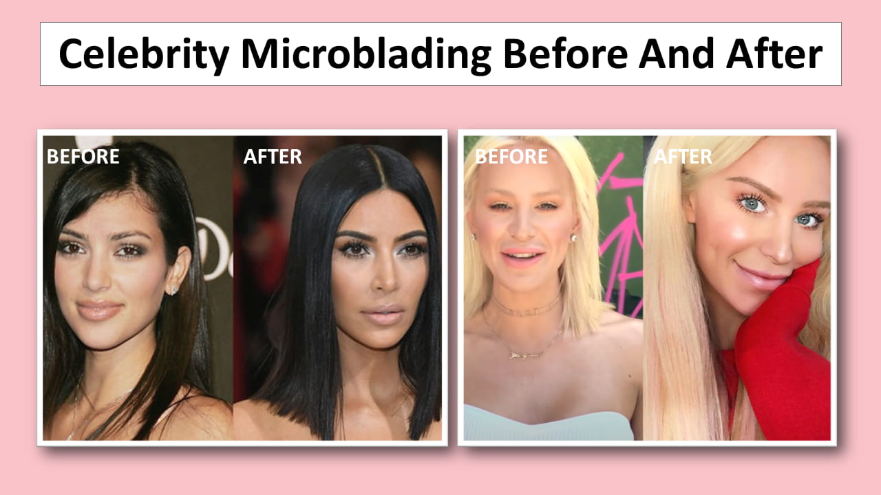 Celebrity Microblading Before And After