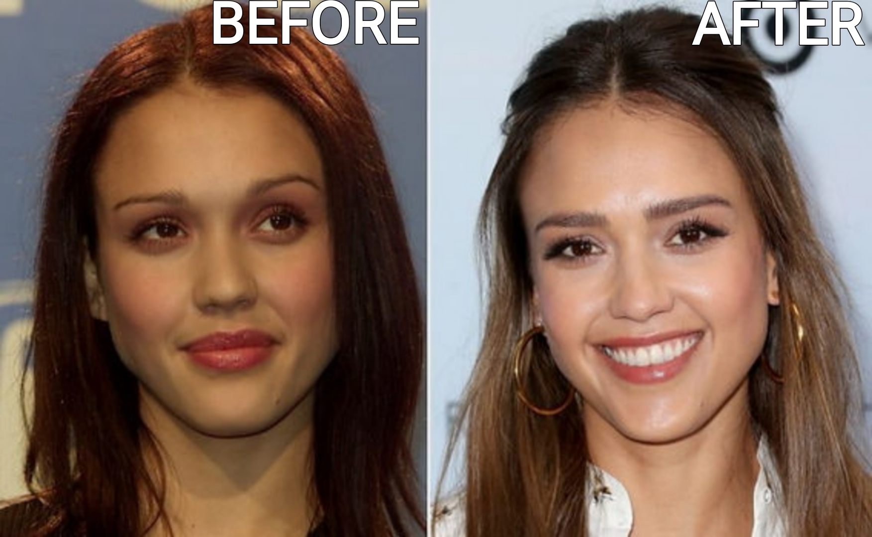 Celebrity Microblading Before And After Pictures Jessica Alba microblading before and after pictures
