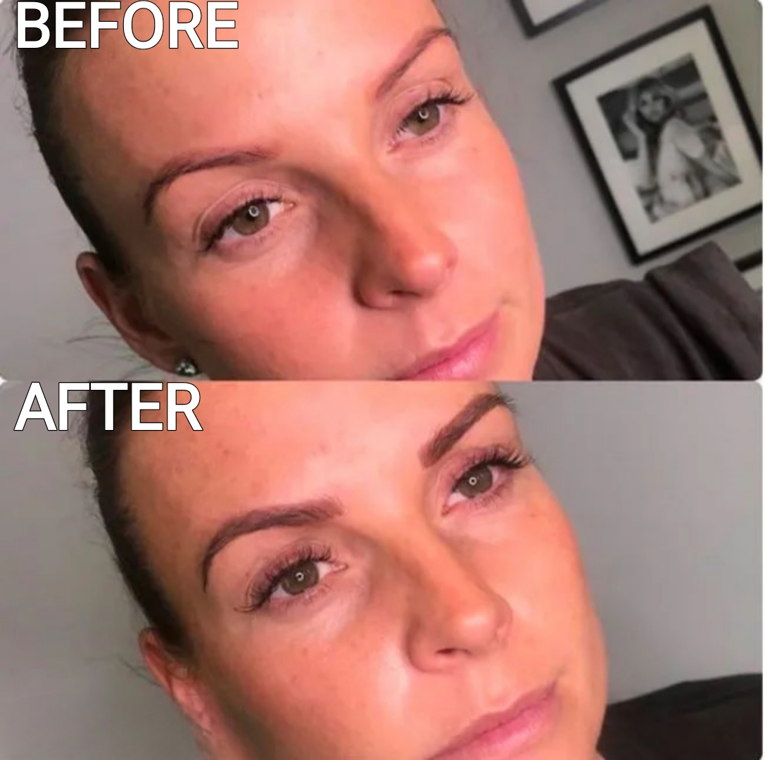 Celebrity Microblading Before And After Pictures coleen rooney microblading before and after