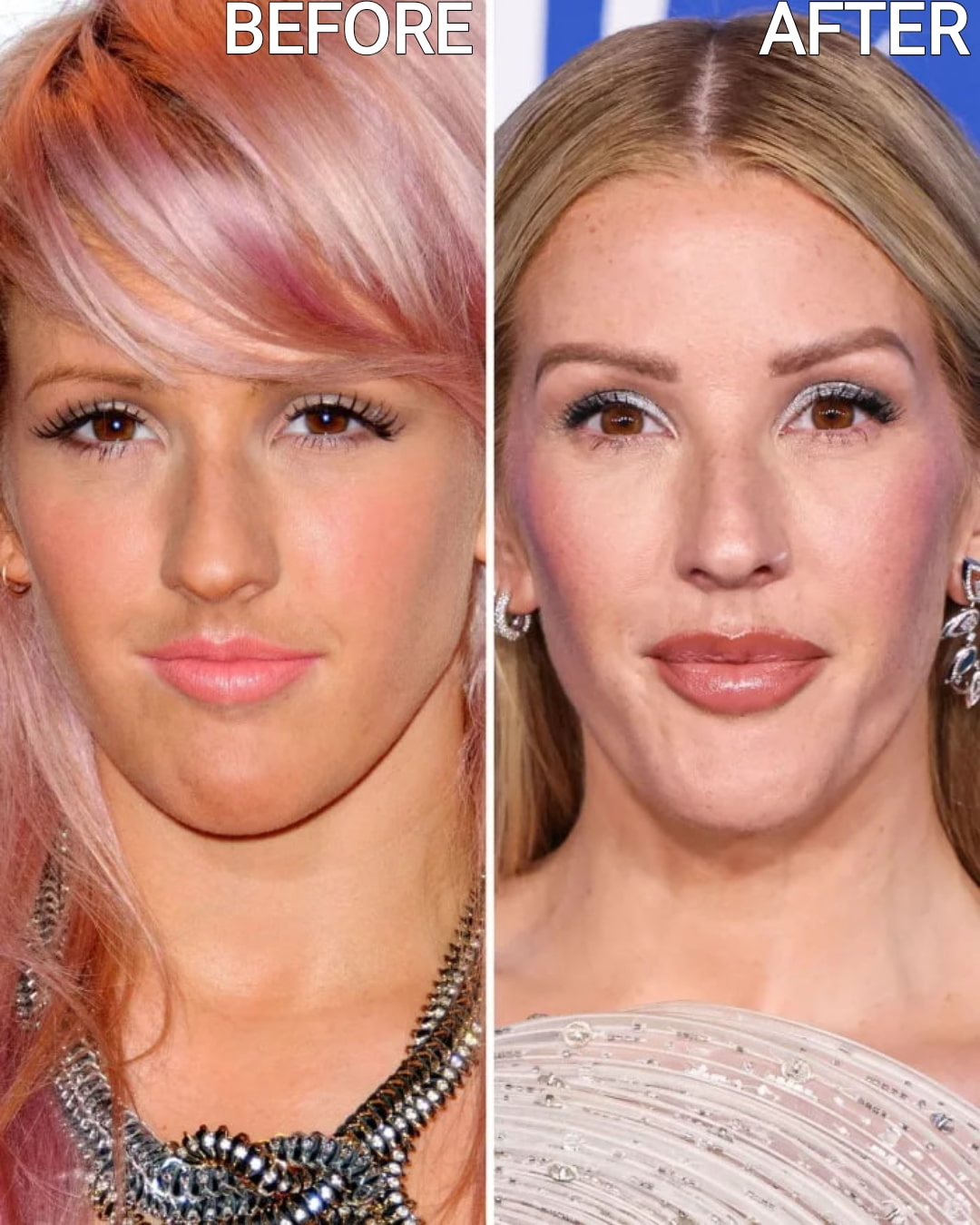 Celebrity Microblading Before And After Pictures ellie goulding microblading before and after look