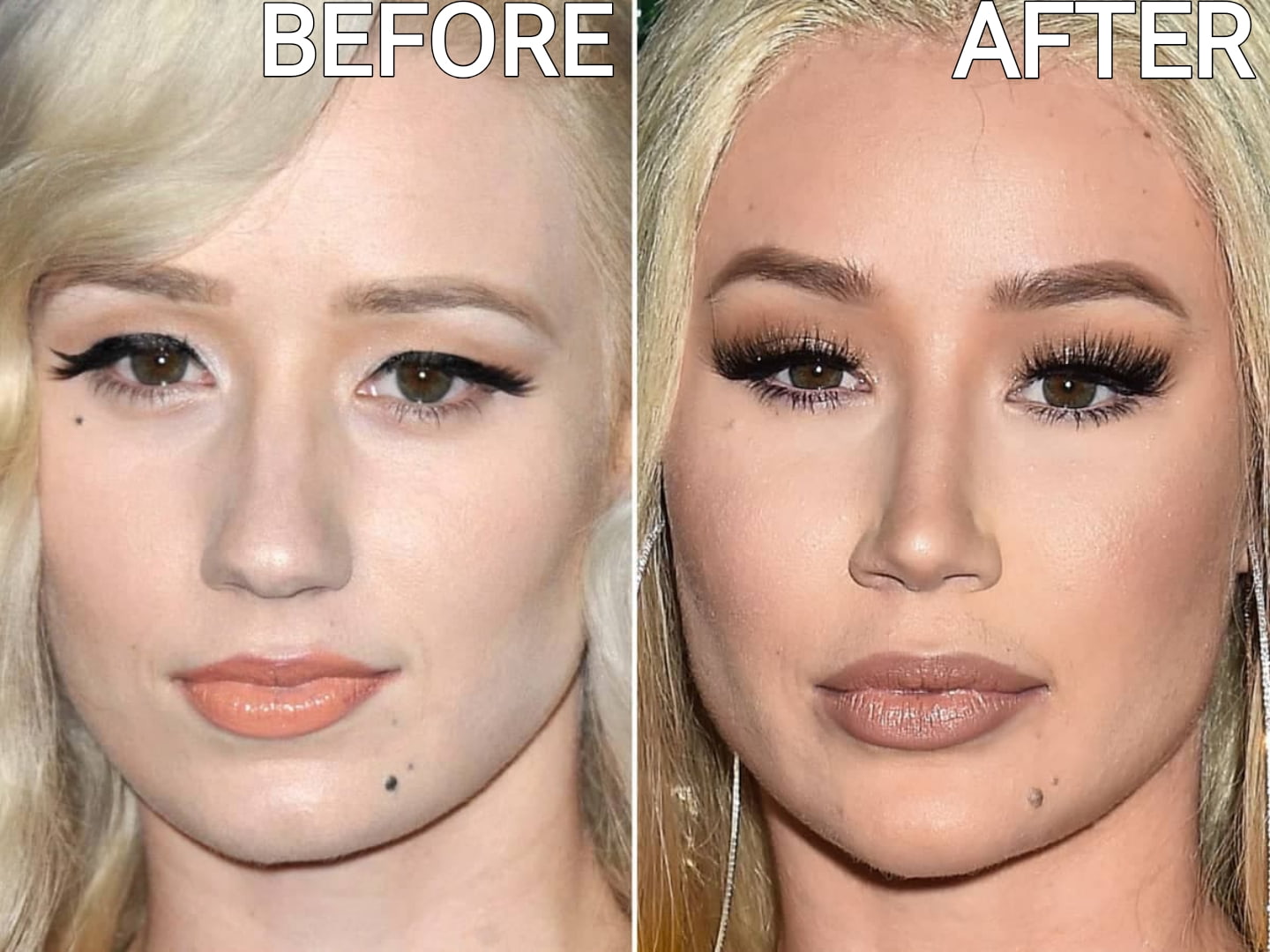 Celebrity Microblading Before And After Pictures iggy azalea microblading before and after