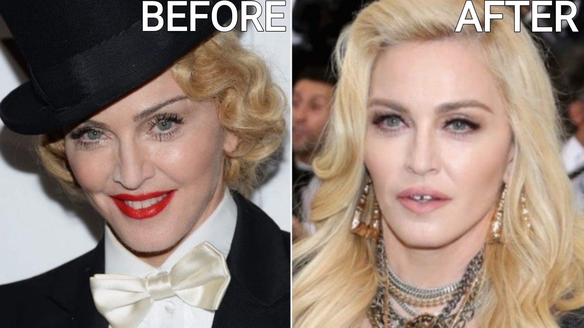 Celebrity Microblading Before And After Pictures madonna microblading before and after results