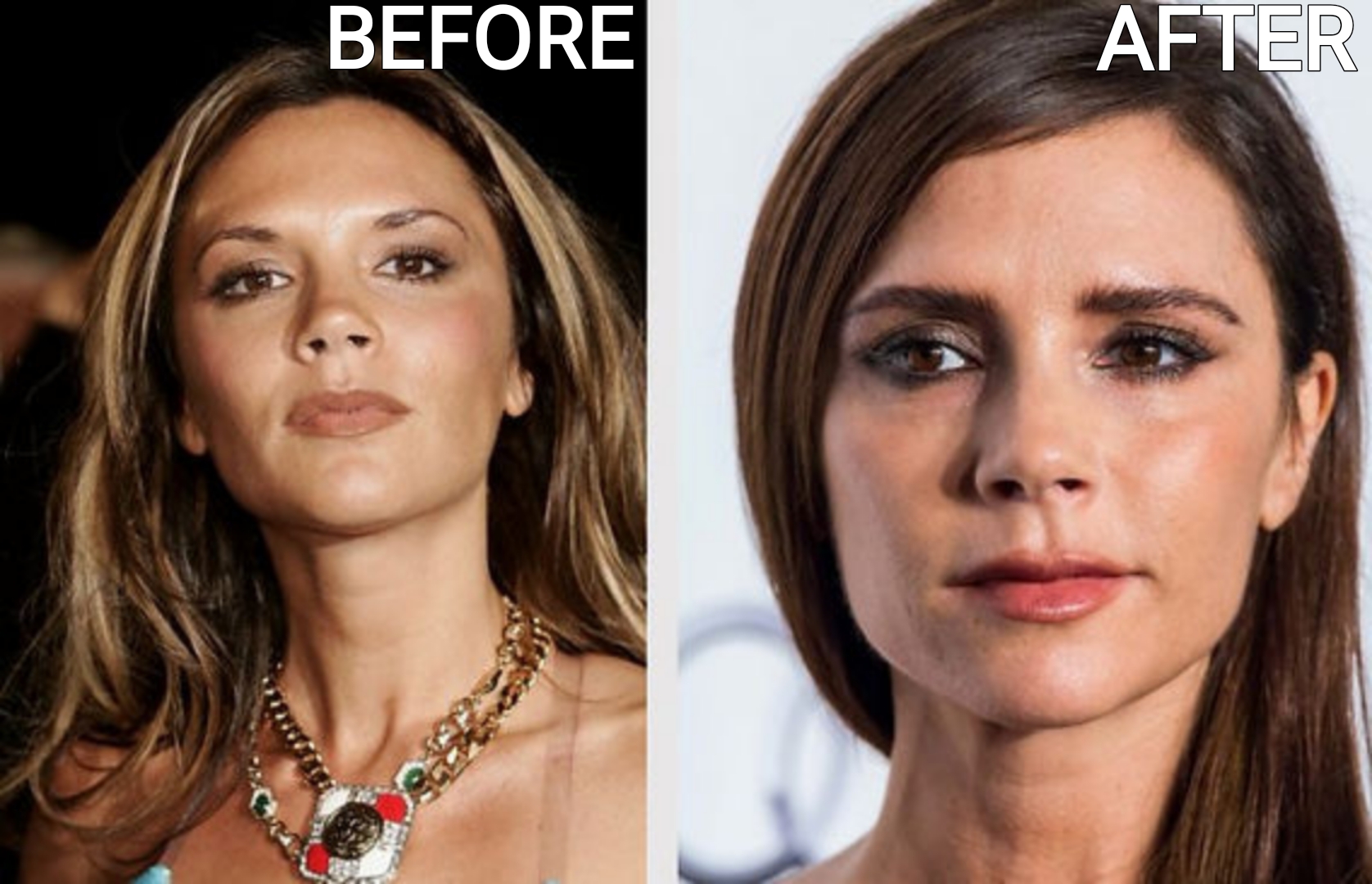 Celebrity Microblading Before And After Pictures victoria beckham microblading before and after results
